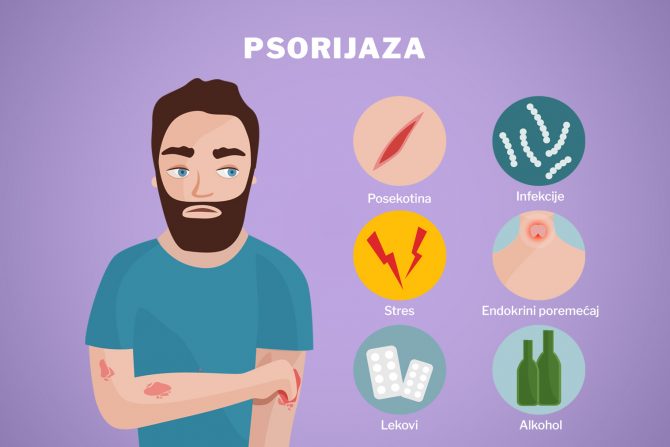 Psorijaza i okidači