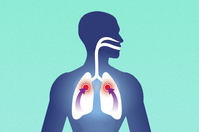 problemi sa disanjem