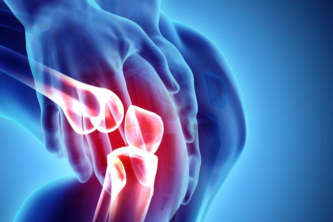 Simptomi koiji ukazuju na artritis kolena