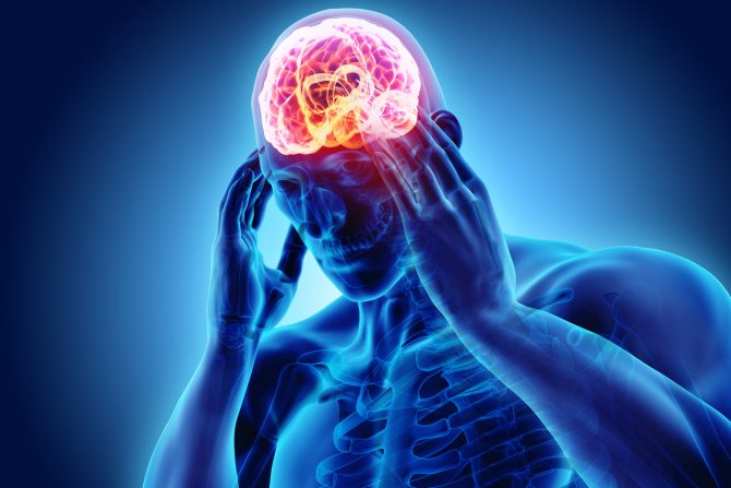 Glavobolja temena glave