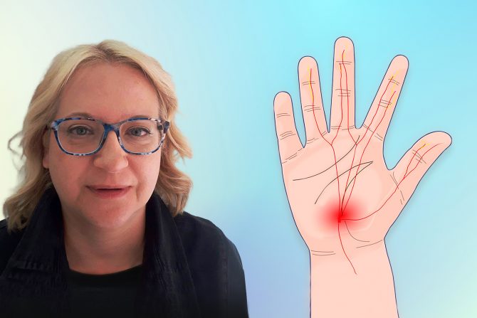 Trnjenje ruku, dr Aleksandra Pavlović