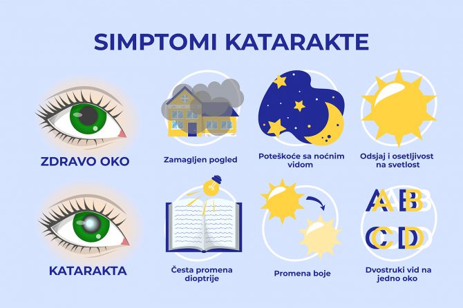 Simptomi katarakte