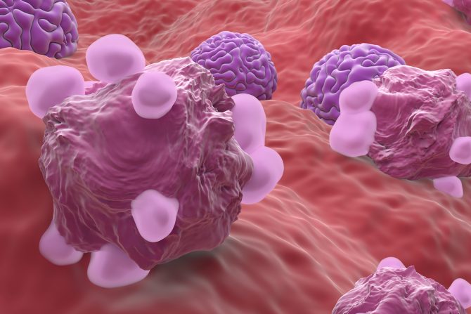 remisija kod kancera