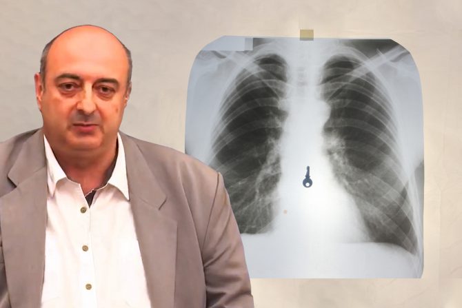 Gutanje predmeta dr Aleksandar Ivković