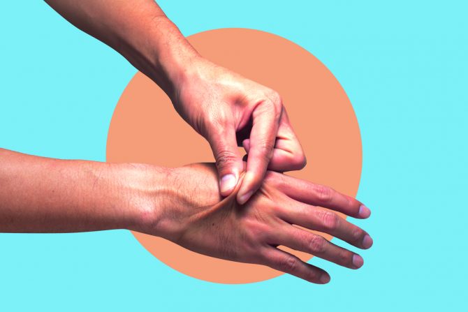 test štipanja kože