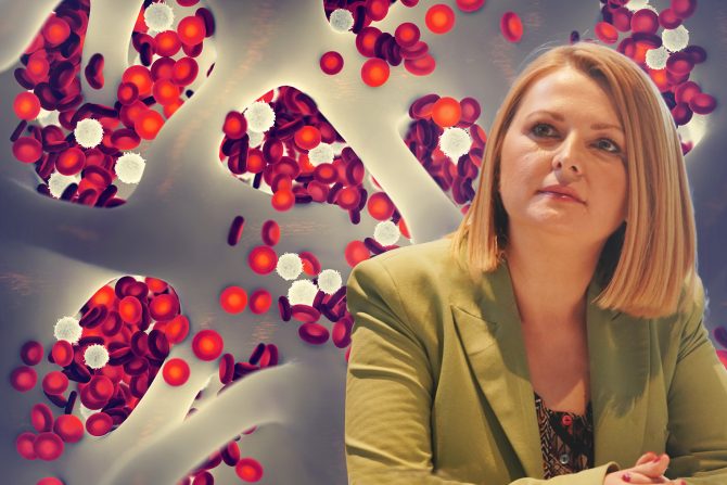 Matične ćelije dr Glorija Blagojević