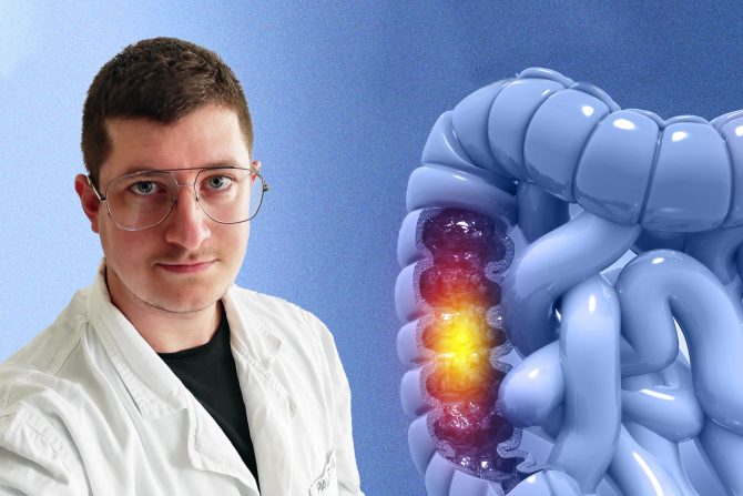 ishrana kod raka debelog creva