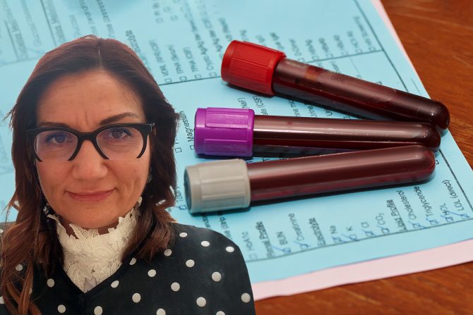 oralni test oprerećenja na glukozu