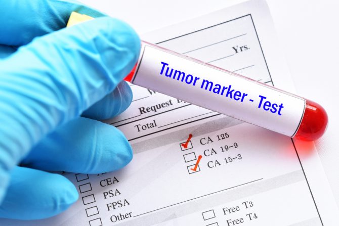 tumor markeri
