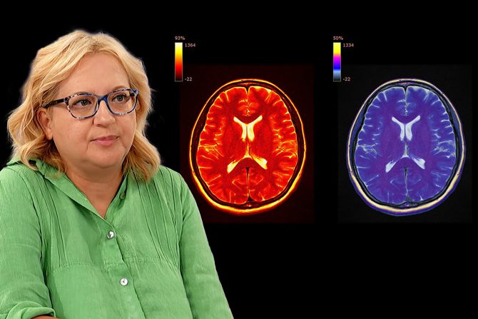 bolest malih krvnih sudova mozga