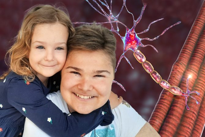 Neizlečiva bolest Dišenova mišićna distrofija