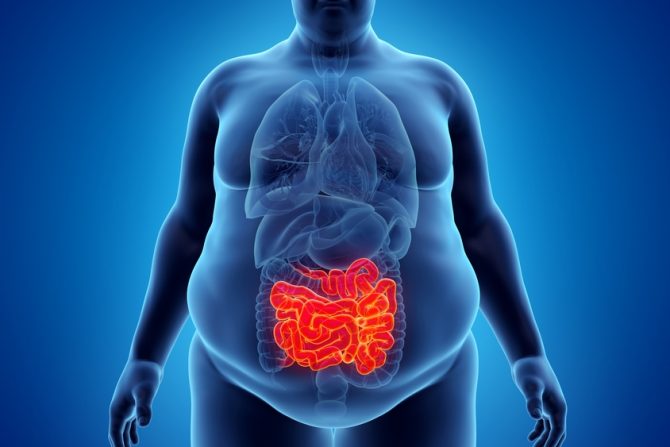 dve vrste gojaznosti