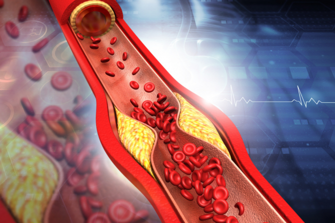 holesterol i trigliceridi