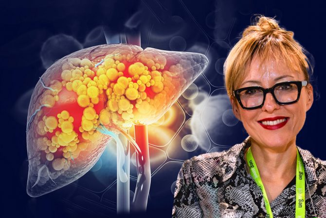 Jetra alkoholna bolest prof.dr Tamara Milovanović