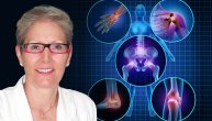 Doktorka koja ima reumatoidni artritis: Ova bolest počinje podmuklim simptomima