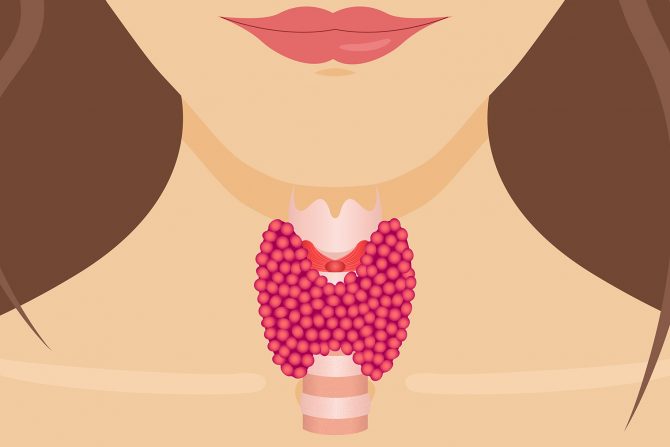 subklinički hipotireoidizam