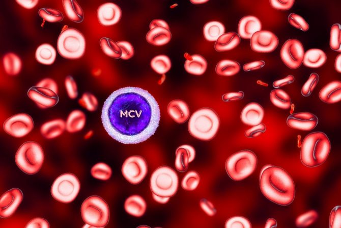 MCV