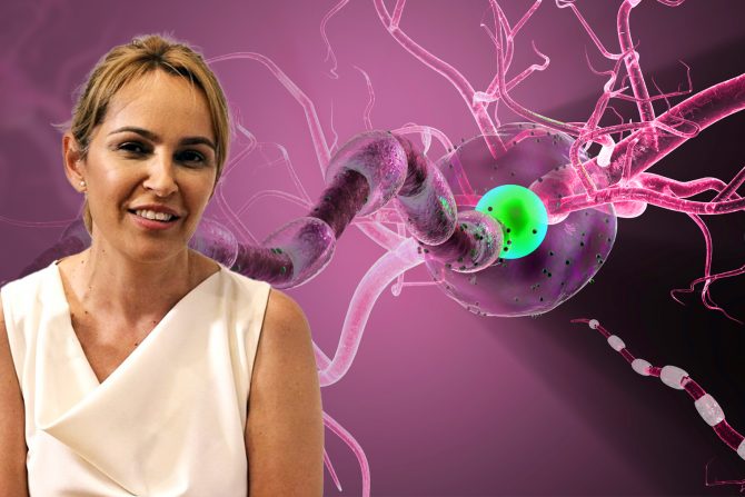 Multipla skleroza Ass.dr Olivera Tamaš