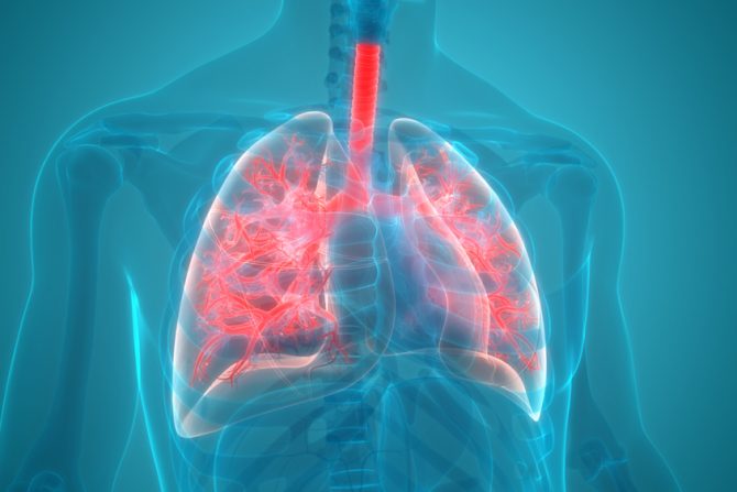 upala pluća opasna po život