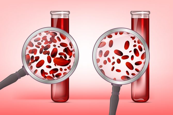 nedostatak fvožša u organizmu