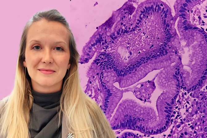 Neuroendokrini tumori dr Valentina Elezović Kovačević