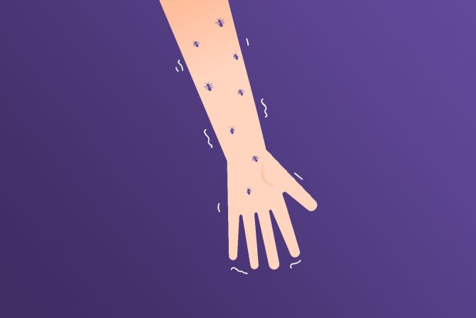 zašto trne desna ruka