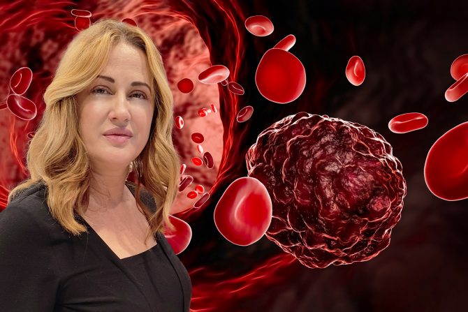 Analize krvi doc dr Danijela Leković