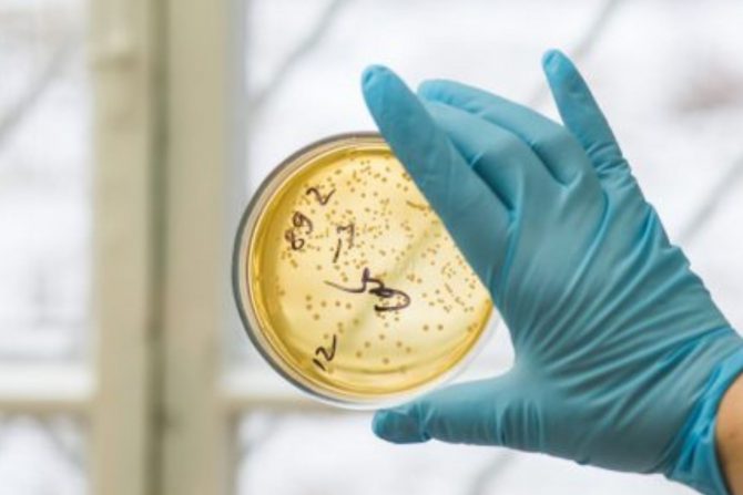 bakterijska infekcija