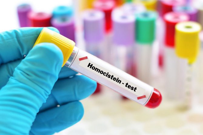 Homocistein