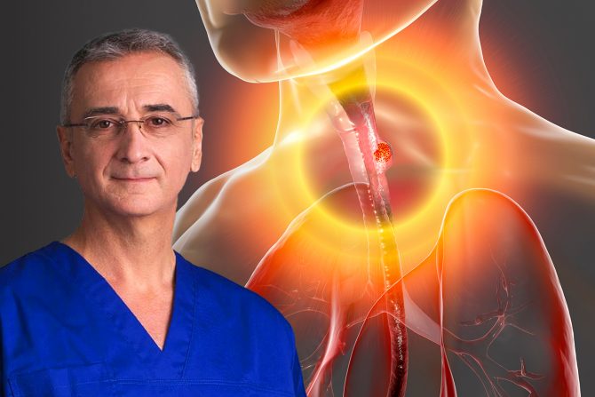 Karcinom jednjaka prof dr Miloš Bjelović