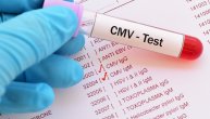 Šta treba znati o citomegalovirusu (CMV) – koje osobe su posebno ugrožene