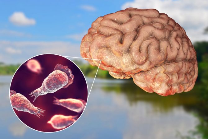 ameba koja jede mozak