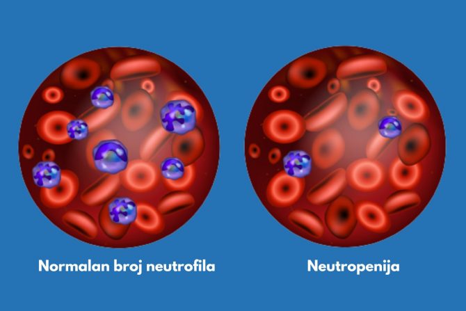 neutrofili u krvi