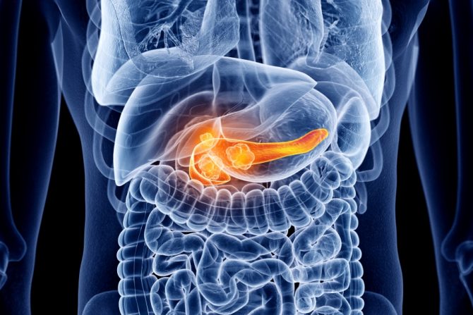 neuroendokrini tumor pankreasa