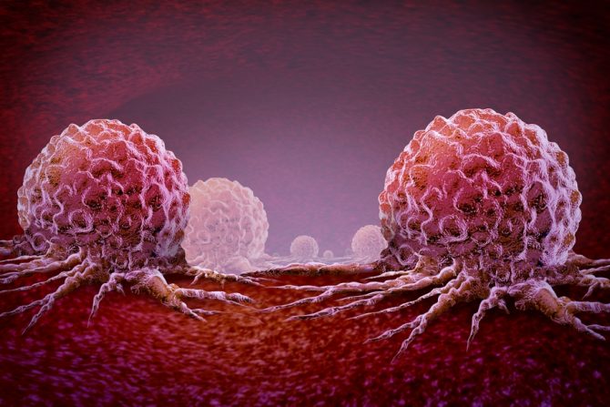 metastatski rak dojke