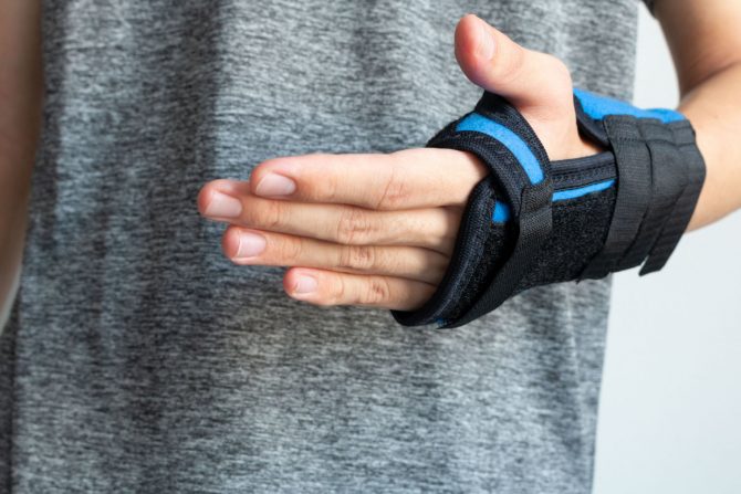 Sindrom karpalnog tunela