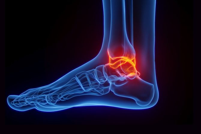 bol u skočnom zglobu