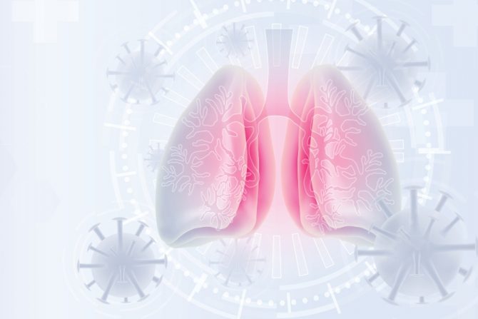 multifokalna pneumonija