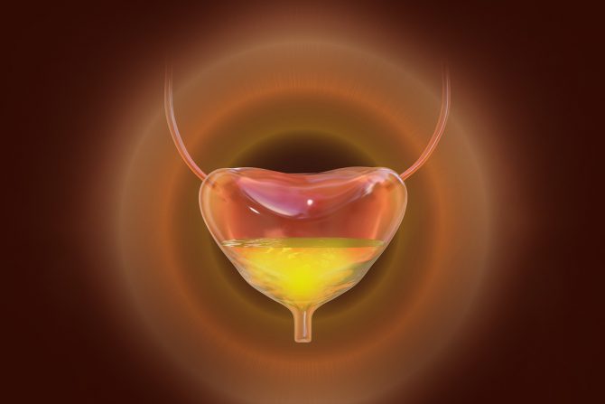 Hiperaktivna bešika