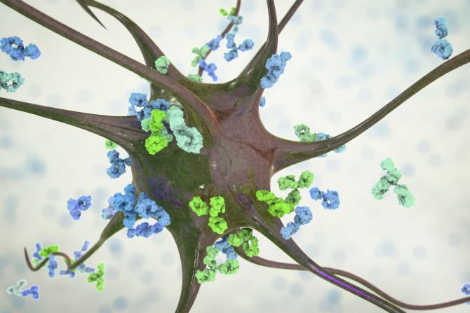 Guillain-Barre sindrom