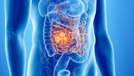 Osećaj „kidanja“ s desne strane abdomena ponekad može da ukaže da tumor narušava varenje