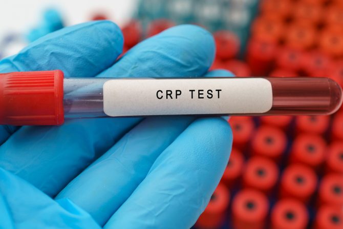 crp test