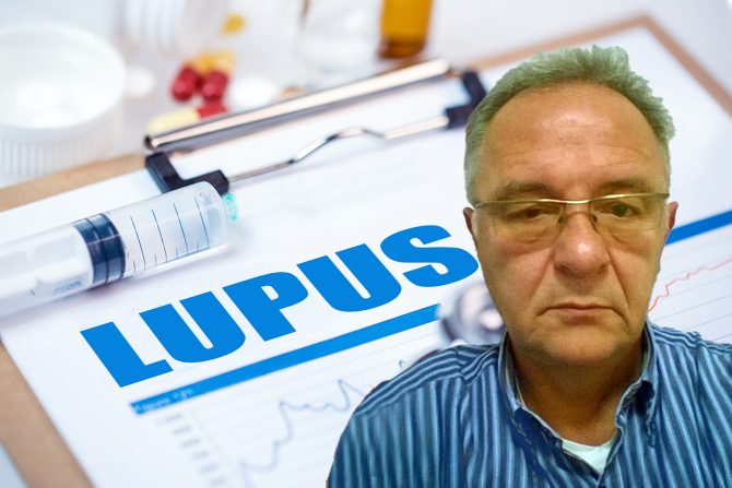 lupus