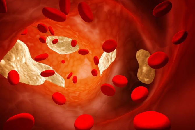 namirnice koje snižavaju holesterol