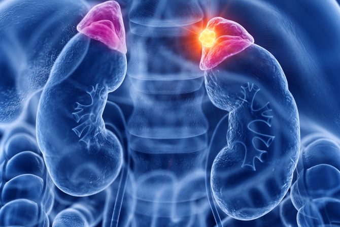 Tumor nadbubrežne žlezde