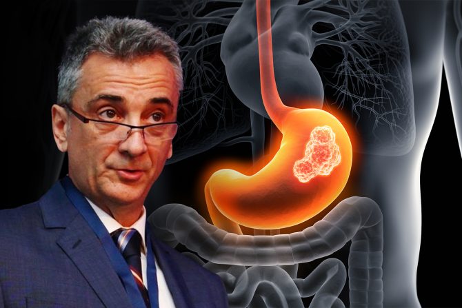 Neuroendokrini tumori želuca