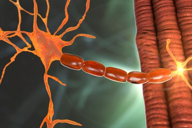 Dišenova mišićna distrofija