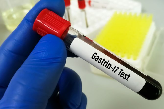 Zollinger-Ellisonov sindrom