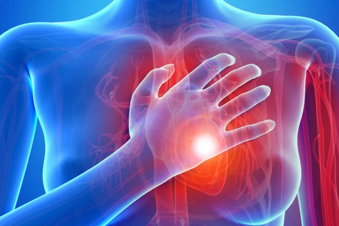 kardiovaskularne bolesti