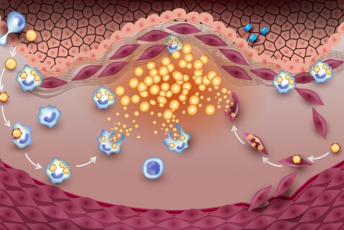 „loš” LDL holesterol